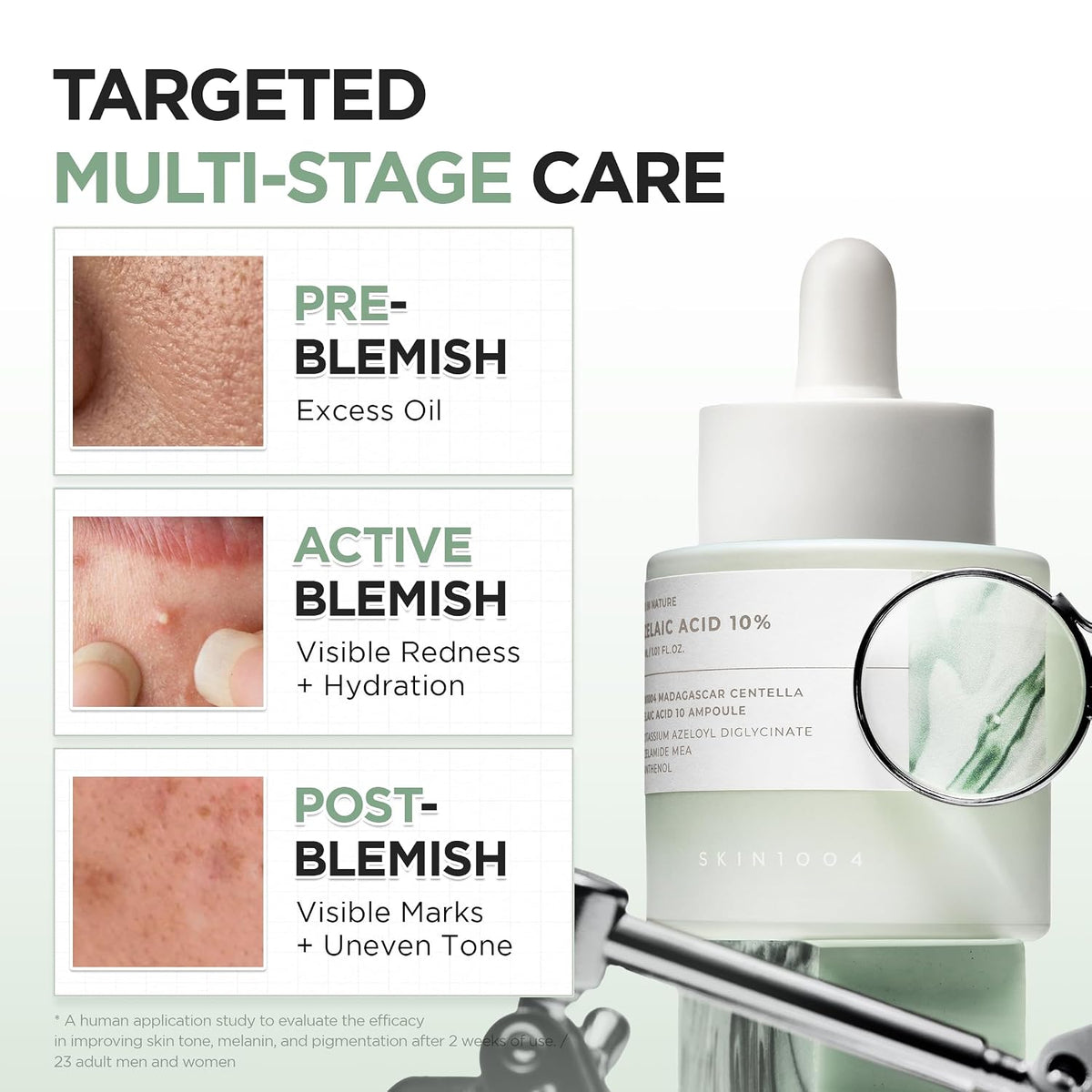 SKIN1004 Madagascar Centella Azelaic Acid 10 Ampoule (30ml)