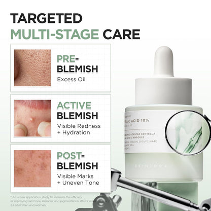 SKIN1004 Madagascar Centella Azelaic Acid 10 Ampoule  (30ml)